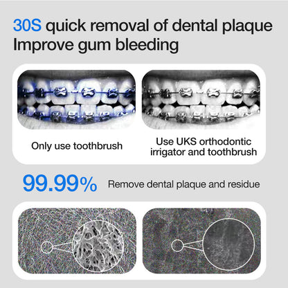 Advertisement for UKS orthodontic irrigator and toothbrush showing dental plaque removal.